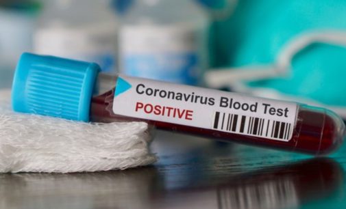 Борьба против коронавируса доказала жизнеспособность ЕС – европейский аналитик