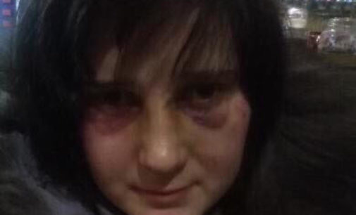 Цинично издевались: Во Львовской области изнасиловали и избили девочку-сироту