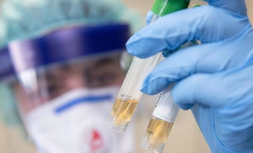 Главный санврач Украины запретил ритуальные обряды на похоронах 