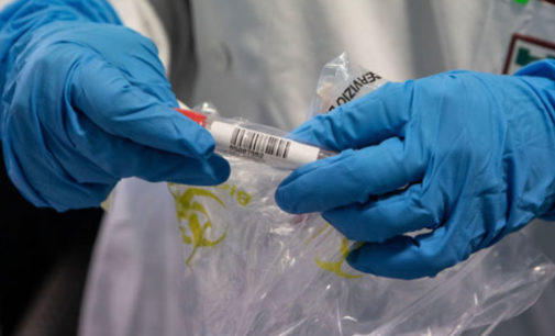 Найден новый симптом опасной болезни: коронавирусные ноги это признаки «обморожения»