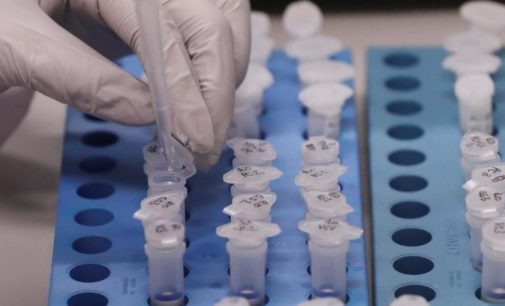 Кличко: За сутки в Киеве от коронавируса умер 1 человек, 32 в тяжелом состоянии