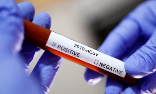 Вспышки Covid-19 в общежитиях Киевщины: власти региона заявили о более 100 больных