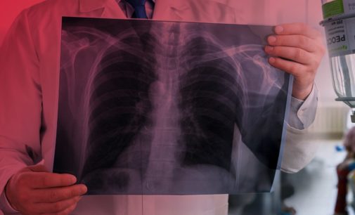 Смерть священника от коронавируса в Тернопольской области: врач рассказала о причинах