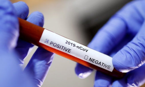 Заразившийся коронавирусом медик детально описал о первых симптомах Covid-19