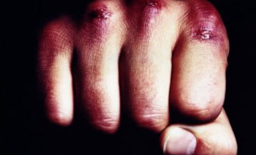 Влез в окно с подельниками: Житель Херсонской области избил возлюбленного своей экс-супруги