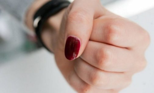 Школьницы жестоко избили 17-летнюю девушку в Коцюбинском под Киевом