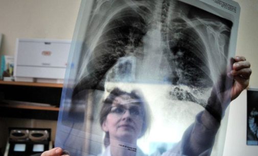 Ученые предупредили о глобальной вспышке туберкулеза из-за карантина