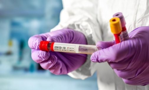 «Визитной карточкой» COVID-19 являются потеря обоняния и вкуса — врач