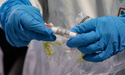 COVID-19 на Закарпатье: число инфицированных превысило 810