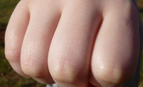 В больнице под Киевом пациент избил врача