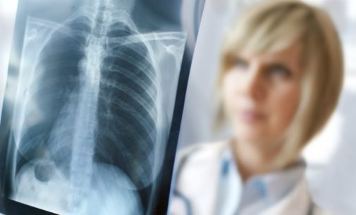 Ж. Карпенко: «В 2021-2022 годах в Украине будет всплеск заболеваемости туберкулезом»