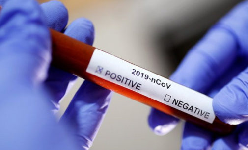 Более 60 стран призвали расследовать происхождение коронавируса